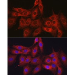 Obg-Like ATPase 1 (OLA1) Antibody