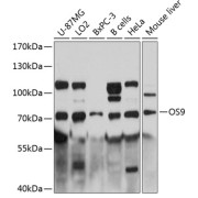 Western blot analysis of extracts of various cell lines using OS9 Antibody (1/3000 dilution).