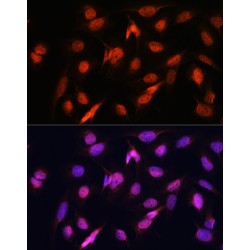 Otubain 1 (OTUB1) Antibody