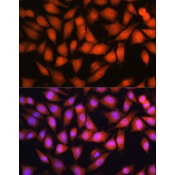 Otubain 1 (OTUB1) Antibody