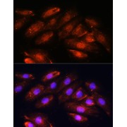 Immunofluorescence analysis of H9C2 cells using OTUB1 Antibody (1/100 dilution). Blue: DAPI for nuclear staining.