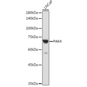 Western blot analysis of extracts of LNCaP cells using PAK4 Antibody (1/1000 dilution).