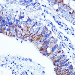 Palladin (PALLD) Antibody