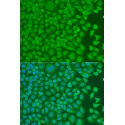 Poly(RC) Binding Protein 1 (PCBP1) Antibody