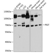 Western blot analysis of extracts of various cell lines using PIGT Antibody (1/3000 dilution).