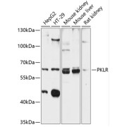 Western blot analysis of extracts of various cell lines using PKLR Antibody (1/3000 dilution).