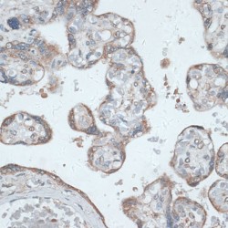 Prostate Transmembrane Protein Androgen Induced 1 (PMEPA1) Antibody