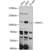 Western blot analysis of extracts of various cell lines using PNPT1 Antibody (1/3000 dilution).