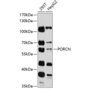 Western blot analysis of extracts of various cell lines using PORCN Antibody (1/3000 dilution).
