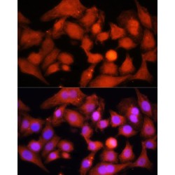 Peroxisome Proliferator Activated Receptor Gamma Coactivator 1 Alpha (PPARGC1A) Antibody