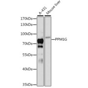 Western blot analysis of extracts of various cell lines using PPM1G Antibody (1/3000 dilution).