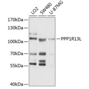 Western blot analysis of extracts of various cell lines using PPP1R13L Antibody (1/1000 dilution).
