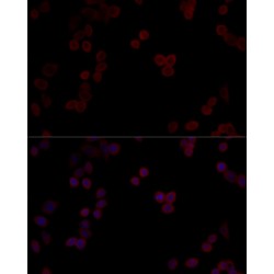 Protein Phosphatase 5 Catalytic Subunit (PPP5C) Antibody
