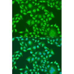 Phosphatidylinositol-3,4,5-Trisphosphate 3-Phosphatase And Dual-Specificity Protein Phosphatase PTEN (PTEN) Antibody