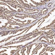 Immunohistochemistry analysis of paraffin-embedded human stomach using PTEN Antibody (1/200 dilution).