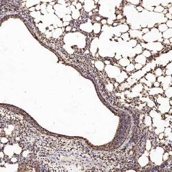 Phosphatidylinositol-3,4,5-Trisphosphate 3-Phosphatase And Dual-Specificity Protein Phosphatase PTEN (PTEN) Antibody