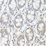 abx126434