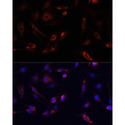 Protein Tyrosine Kinase 2 Beta (PTK2) Antibody
