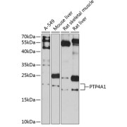 Western blot analysis of extracts of various cell lines using PTP4A1 Antibody (1/3000 dilution).