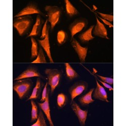 Ras-Related Protein Rab-21 (RAB21) Antibody