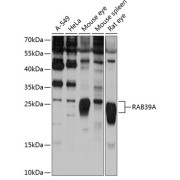Western blot analysis of extracts of various cell lines using RAB39A Antibody (1/1000 dilution).