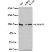 Western blot analysis of extracts of various cell lines using RANBP9 Antibody (1/3000 dilution).