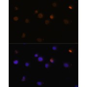 Immunofluorescence analysis of Y79 cells using Rb Antibody (1/100 dilution, 40x lens). Blue: DAPI for nuclear staining.