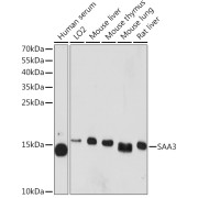 Western blot analysis of extracts of various cell lines using SAA3 Antibody (1/1000 dilution).