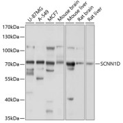 Western blot analysis of extracts of various cell lines using SCNN1D Antibody (1/1000 dilution).