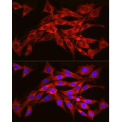 Protein Transport Protein Sec61 Subunit Alpha Isoform 1 (SEC61A1) Antibody