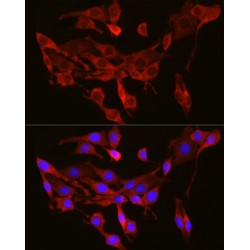 Protein Transport Protein Sec61 Subunit Alpha Isoform 1 (SEC61A1) Antibody