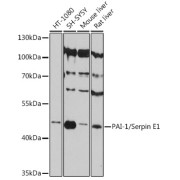 Western blot analysis of extracts of various cell lines using PAI-1/Serpin E1 Antibody (1/3000 dilution).