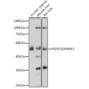 abx126532
