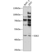 Western blot analysis of extracts of various cell lines using SGK2 Antibody (1/1000 dilution).