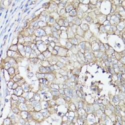 Monocarboxylate Transporter 4 / MCT4 (SLC16A3) Antibody