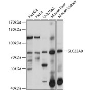 Western blot analysis of extracts of various cell lines using SLC22A9 Antibody (1/1000 dilution).