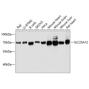 Western blot analysis of extracts of various cell lines using SLC25A12 Antibody (1/3000 dilution).