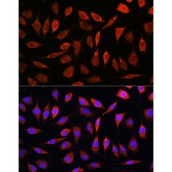Solute Carrier Family 39, Member 8 (SLC39A8) Antibody