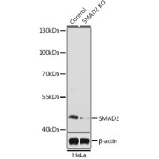 Western blot analysis of extracts from normal (control) and SMAD2 knockout (KO) HeLa cells using SMAD2 Antibody (1/1000 dilution).