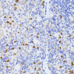 Mothers Against Decapentaplegic Homolog 2 (Smad2) Antibody