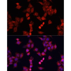 Mothers Against Decapentaplegic Homolog 2 (Smad2) Antibody