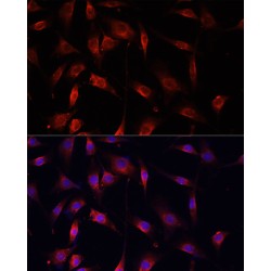 Mothers Against Decapentaplegic Homolog 2 (Smad2) Antibody
