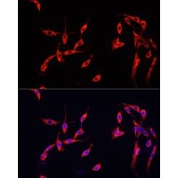 Mothers Against Decapentaplegic Homolog 2 (Smad2) Antibody