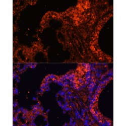Spectrin Alpha Chain, Erythrocytic 1 (SPTA1) Antibody