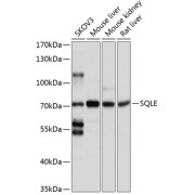 Western blot analysis of extracts of various cell lines using SQLE Antibody (1/1000 dilution).