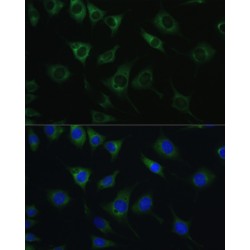 SRP Receptor Beta Subunit (SRPRB) Antibody