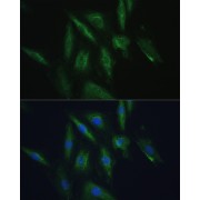 Immunofluorescence analysis of H9C2 cells using SRPRB Antibody (1/100 dilution). Blue: DAPI for nuclear staining.