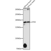 Western blot analysis of extracts of various cell lines using STK36 Antibody (1/1000 dilution).