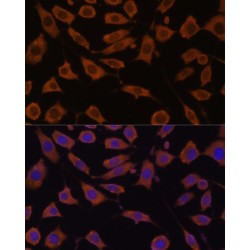 STIP1 Homology And U-Box Containing Protein 1 (STUB1) Antibody