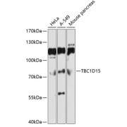 Western blot analysis of extracts of various cell lines using TBC1D15 Antibody (1/1000 dilution).